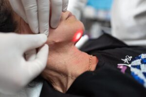 Il Dott. Carmine Mele durante una seduta di trattamento laser.